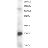 Western Blot - Anti-PINX1/LPTS Antibody (A83813) - Antibodies.com