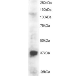 Western Blot - Anti-PINX1 Antibody (A83813) - Antibodies.com