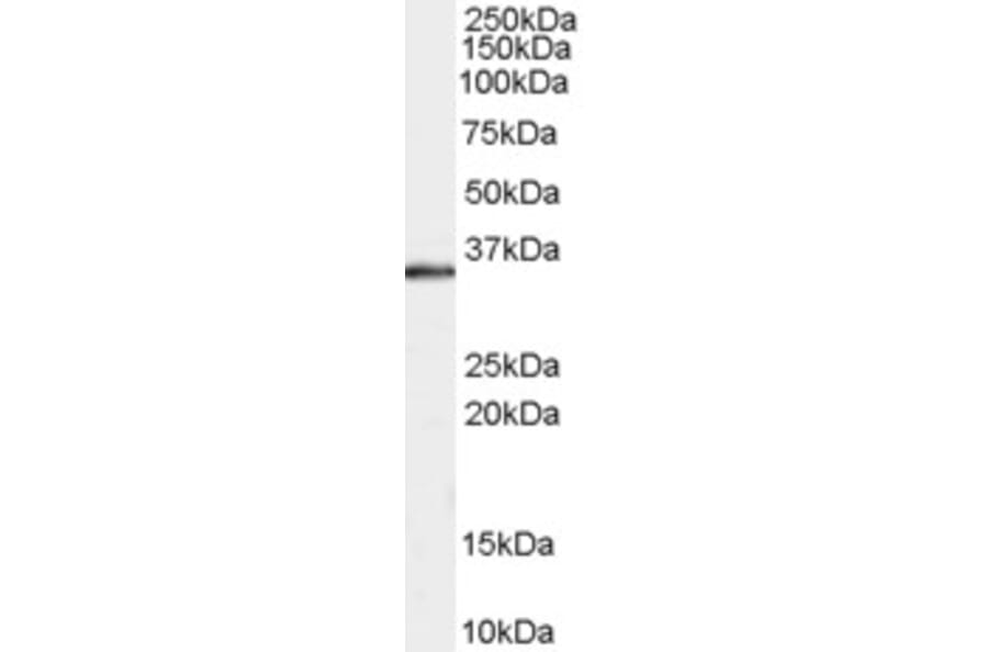 Western Blot - Anti-STUB1/CHIP Antibody (A83814) - Antibodies.com