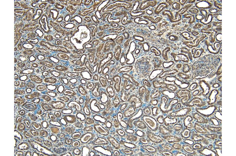 Immunohistochemistry - Anti-STUB1/CHIP Antibody (A83814) - Antibodies.com