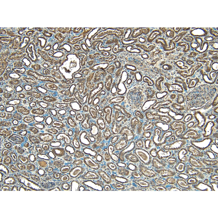 Immunohistochemistry - Anti-STUB1/CHIP Antibody (A83814) - Antibodies.com