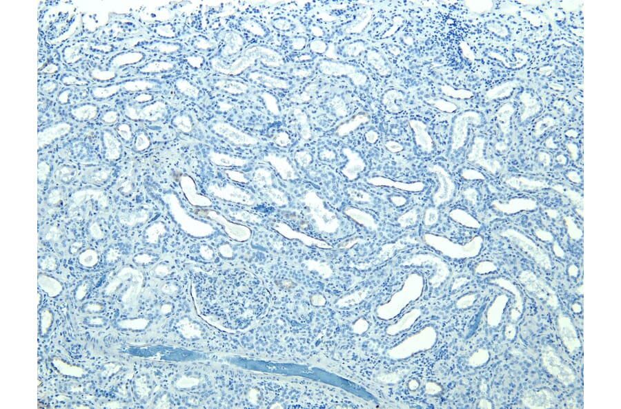Immunohistochemistry - Anti-STUB1/CHIP Antibody (A83814) - Antibodies.com