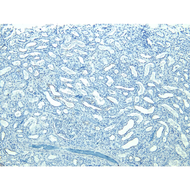 Immunohistochemistry - Anti-STUB1/CHIP Antibody (A83814) - Antibodies.com
