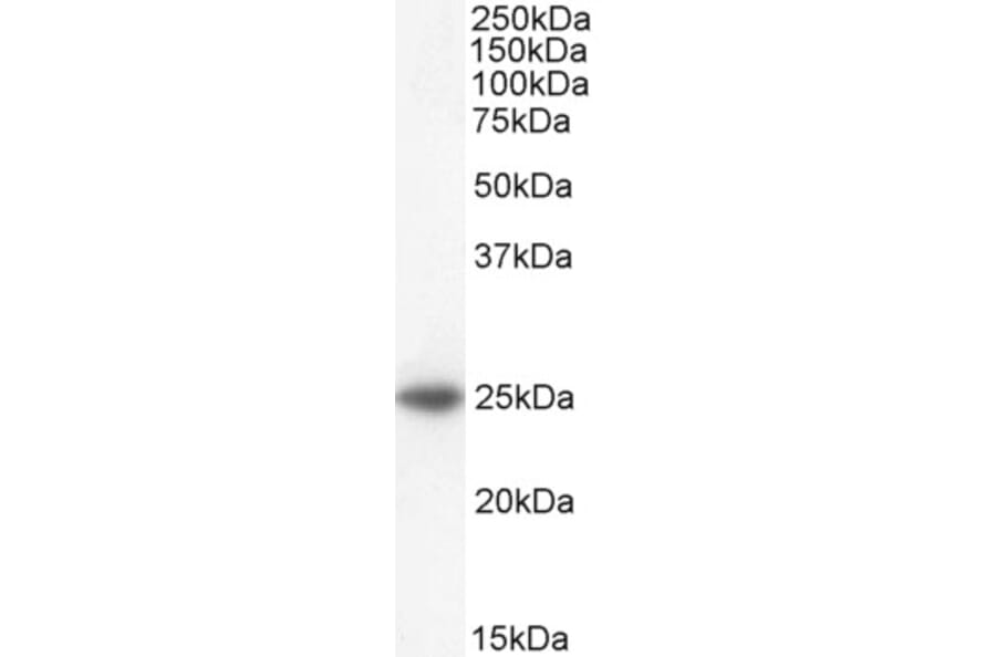 Western Blot - Anti-Bak Antibody (A83815) - Antibodies.com