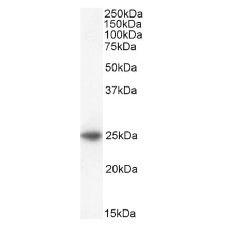 Western Blot - Anti-BAK1 Antibody (A83815)