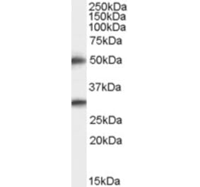 Western Blot - Anti-TMPRSS5 Antibody (A83817) - Antibodies.com