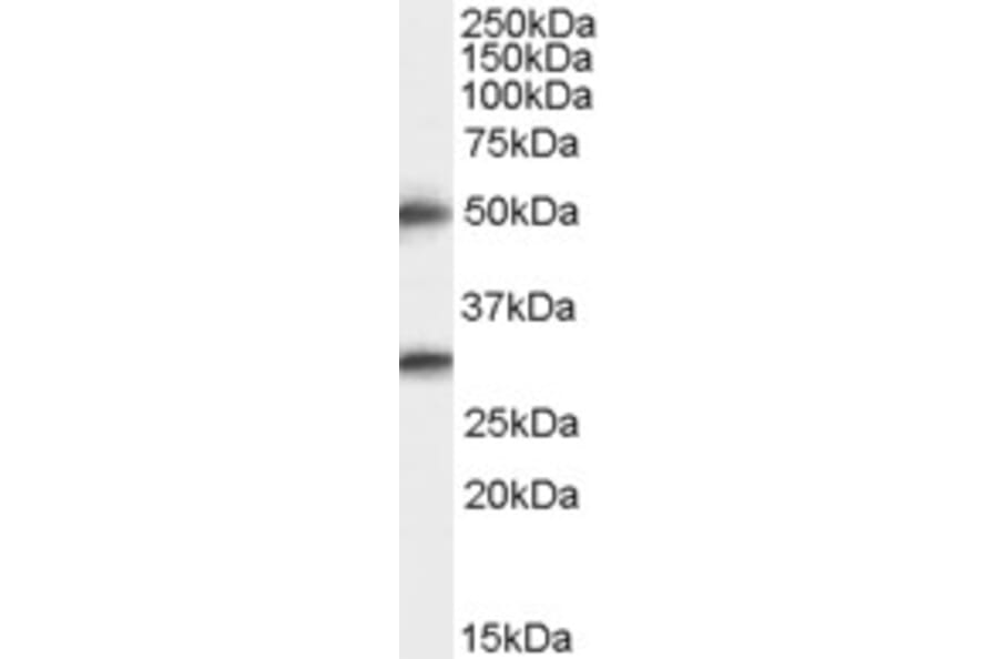 Western Blot - Anti-TMPRSS5 Antibody (A83817) - Antibodies.com