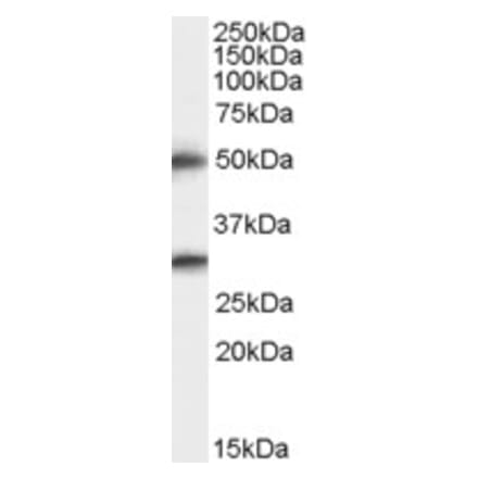 Western Blot - Anti-TMPRSS5 Antibody (A83817) - Antibodies.com