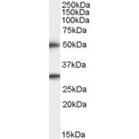 Western Blot - Anti-TMPRSS5 Antibody (A83817) - Antibodies.com