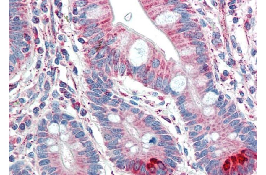 Immunohistochemistry - Anti-TMPRSS5 Antibody (A83817) - Antibodies.com