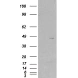 Western Blot - Anti-SKAP2 Antibody (A83818) - Antibodies.com