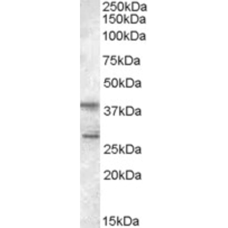 Western Blot - Anti-SKAP2 Antibody (A83818) - Antibodies.com