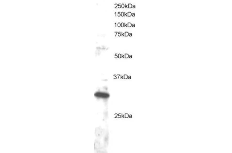 Western Blot - Anti-DKK4 Antibody (A83819) - Antibodies.com