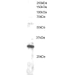 Western Blot - Anti-DKK4 Antibody (A83819) - Antibodies.com
