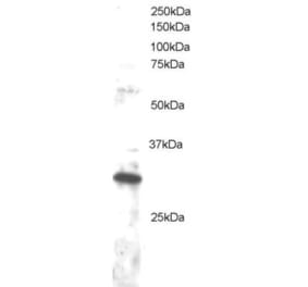 Western Blot - Anti-DKK4 Antibody (A83819) - Antibodies.com