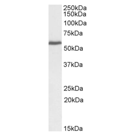 Western Blot - Anti-PRPF31 Antibody (A83820) - Antibodies.com