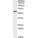 Western Blot - Anti-PRPF31 Antibody (A83820) - Antibodies.com
