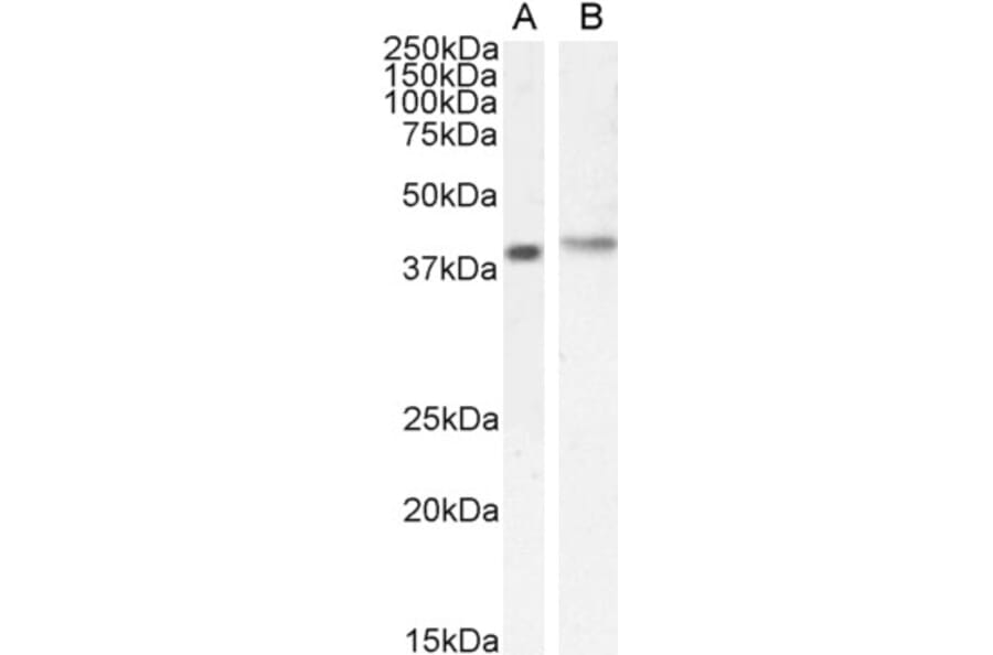 Western Blot - Anti-CASP Antibody (A83821) - Antibodies.com