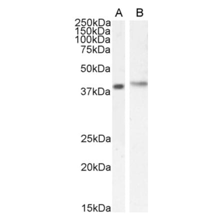Western Blot - Anti-CASP Antibody (A83821) - Antibodies.com