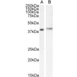 Western Blot - Anti-CASP Antibody (A83821) - Antibodies.com