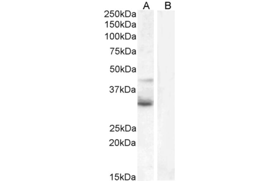 Western Blot - Anti-Wnt4 Antibody (A83822) - Antibodies.com