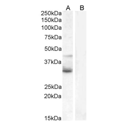 Western Blot - Anti-Wnt4 Antibody (A83822) - Antibodies.com