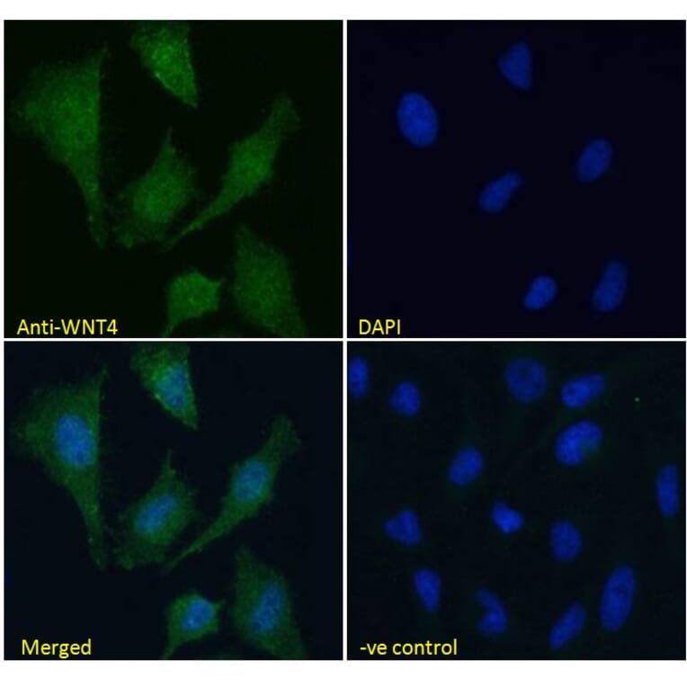 Immunofluorescence - Anti-Wnt4 Antibody (A83822) - Antibodies.com