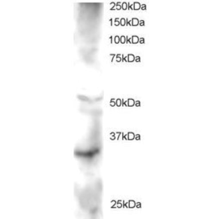 Western Blot - Anti-GSK3 Antibody (A83823) - Antibodies.com