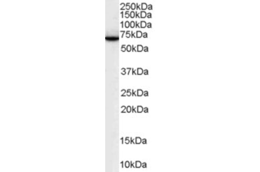 Western Blot - Anti-SWAP70 Antibody (A83824) - Antibodies.com
