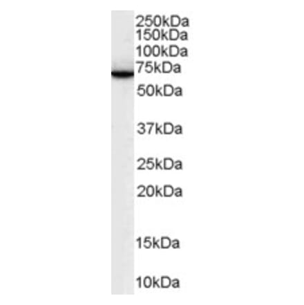 Western Blot - Anti-SWAP70 Antibody (A83824) - Antibodies.com