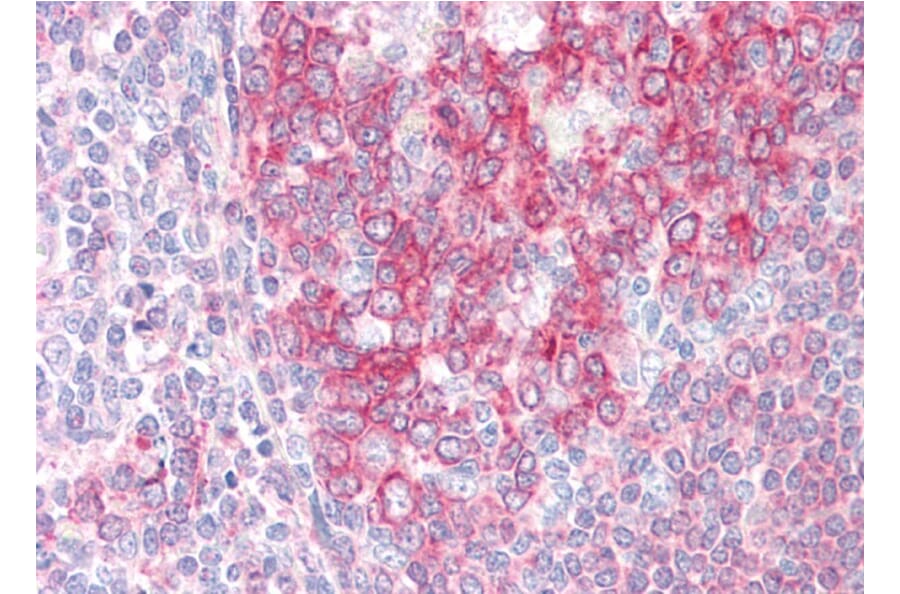 Immunohistochemistry - Anti-SWAP70 Antibody (A83824) - Antibodies.com