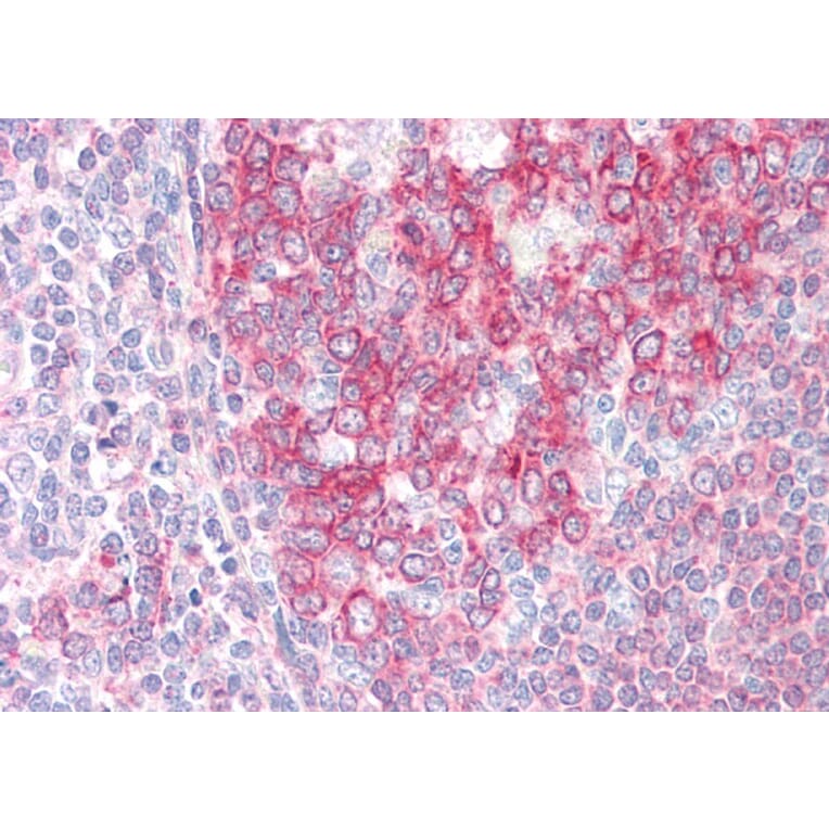 Immunohistochemistry - Anti-SWAP70 Antibody (A83824) - Antibodies.com