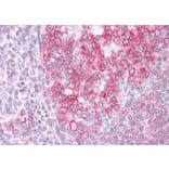 Immunohistochemistry - Anti-SWAP70 Antibody (A83824) - Antibodies.com