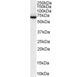 Western Blot - Anti-SWAP70 Antibody (A83824) - Antibodies.com