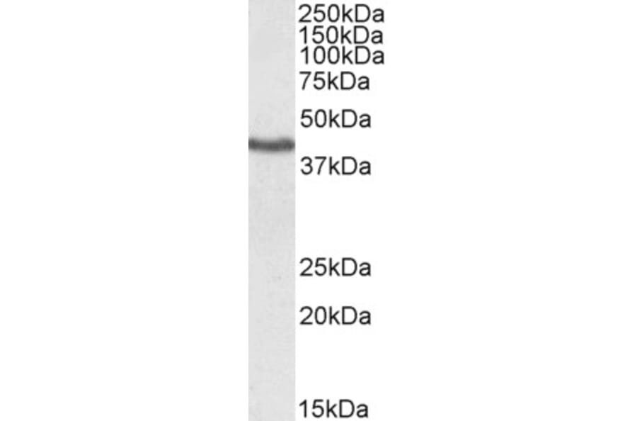 Western Blot - Anti-KLF3 Antibody (A83826) - Antibodies.com