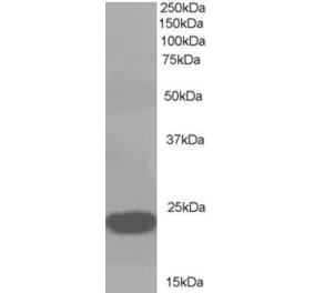 Western Blot - Anti-RKIP Antibody (A83828) - Antibodies.com