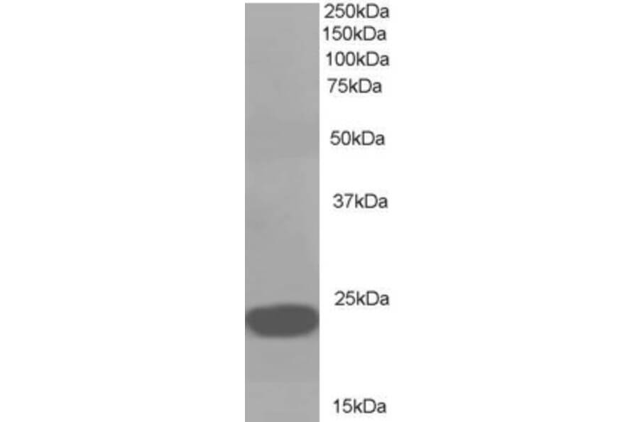 Western Blot - Anti-RKIP Antibody (A83828) - Antibodies.com