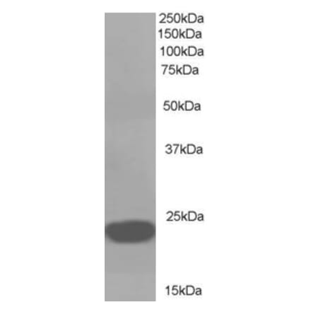 Western Blot - Anti-RKIP Antibody (A83828) - Antibodies.com