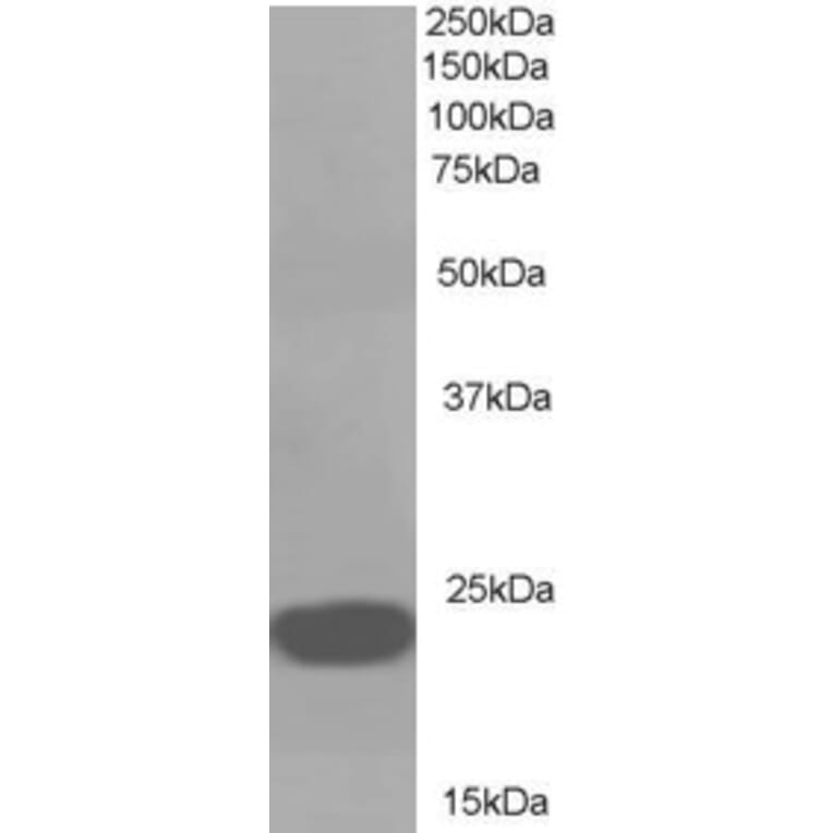 Western Blot - Anti-RKIP Antibody (A83828) - Antibodies.com