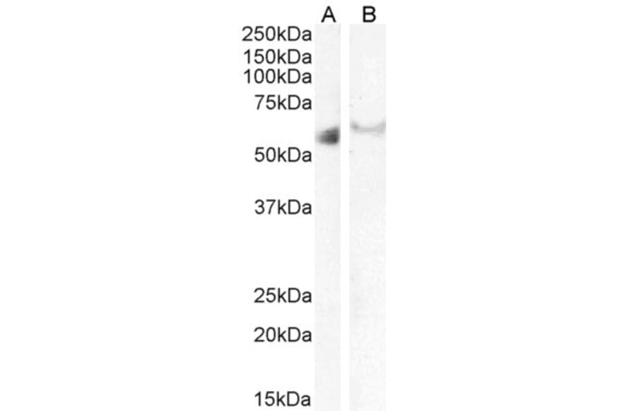 Western Blot - Anti-IRF6 Antibody (A83829) - Antibodies.com