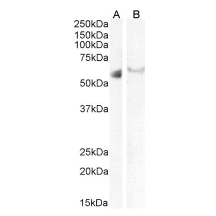 Western Blot - Anti-IRF6 Antibody (A83829) - Antibodies.com