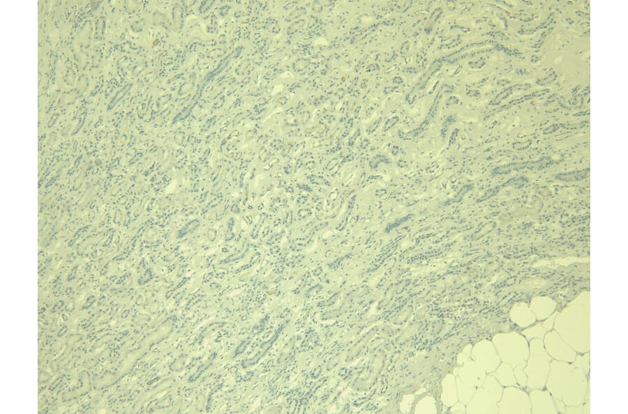 Immunohistochemistry - Anti-IRF6 Antibody (A83829) - Antibodies.com