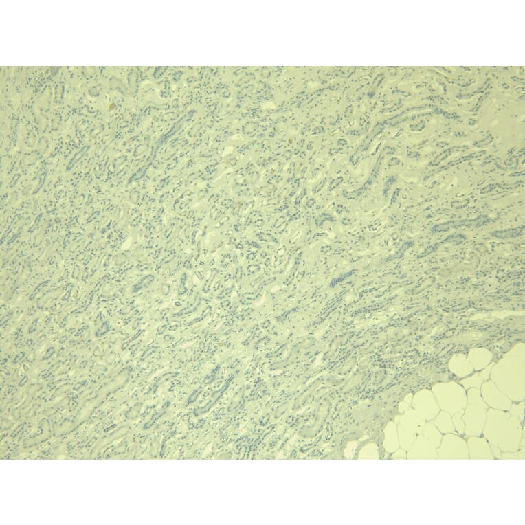 Immunohistochemistry - Anti-IRF6 Antibody (A83829) - Antibodies.com