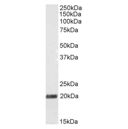Western Blot - Anti-SCG10 Antibody (A83830) - Antibodies.com