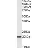 Western Blot - Anti-SCG10 Antibody (A83830) - Antibodies.com