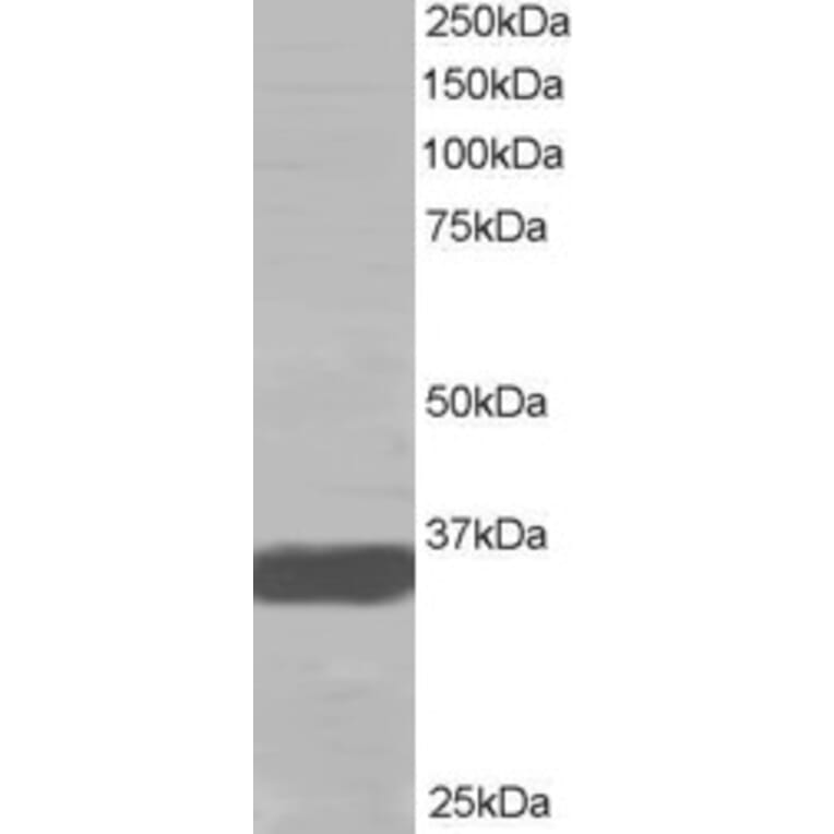 Western Blot - Anti-MRGX Antibody (A83831) - Antibodies.com