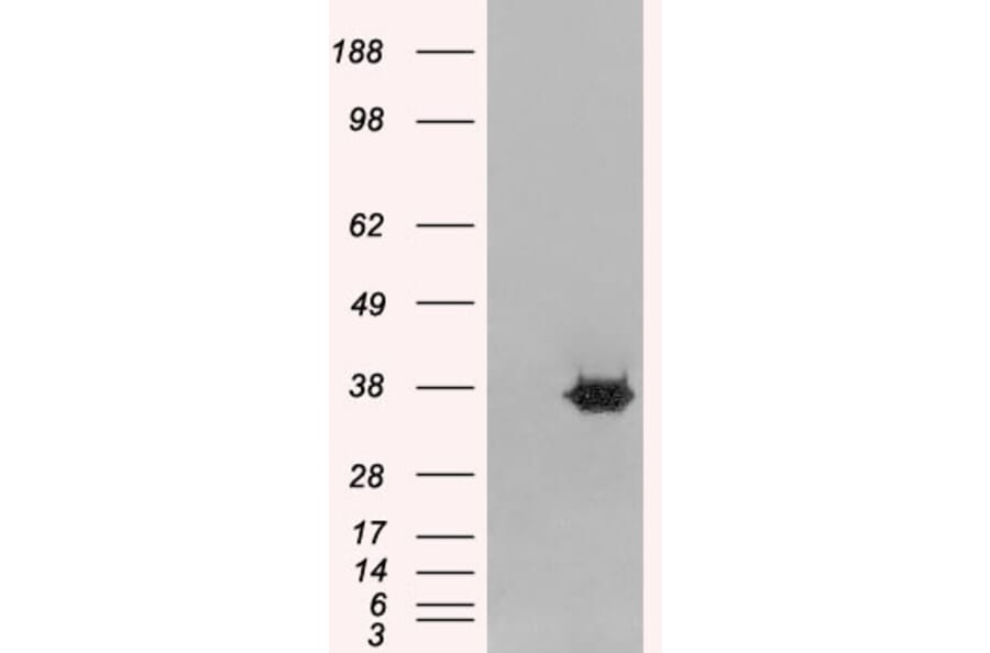 Western Blot - Anti-MRGX Antibody (A83831) - Antibodies.com