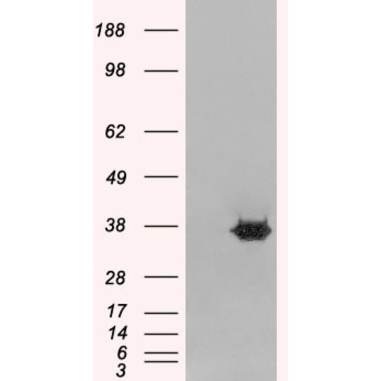 Western Blot - Anti-MRGX Antibody (A83831) - Antibodies.com