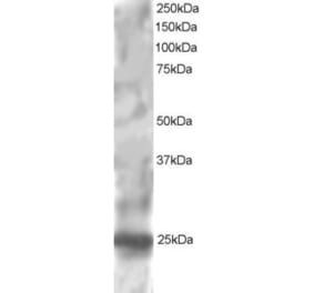 Western Blot - Anti-RGS1 Antibody (A83832) - Antibodies.com