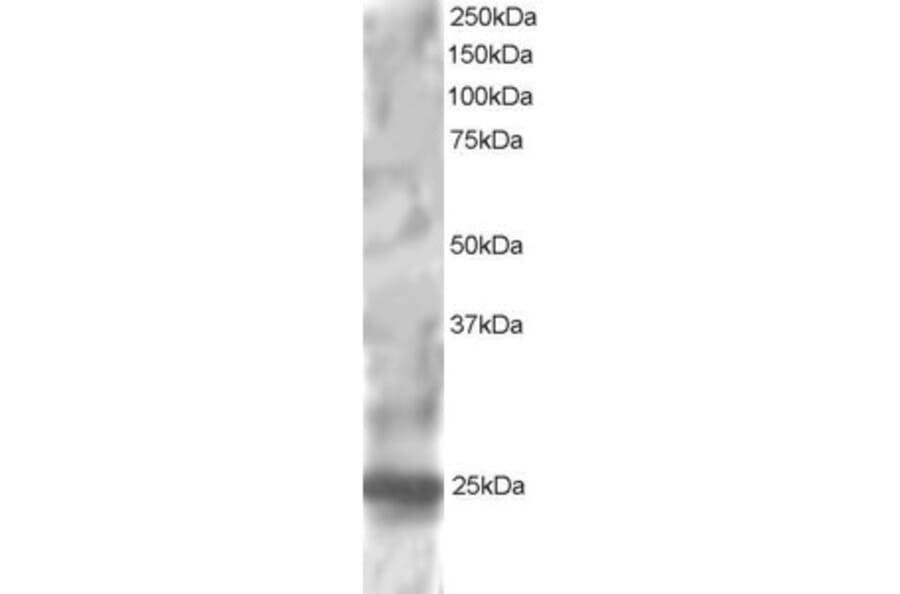 Western Blot - Anti-RGS1 Antibody (A83832) - Antibodies.com